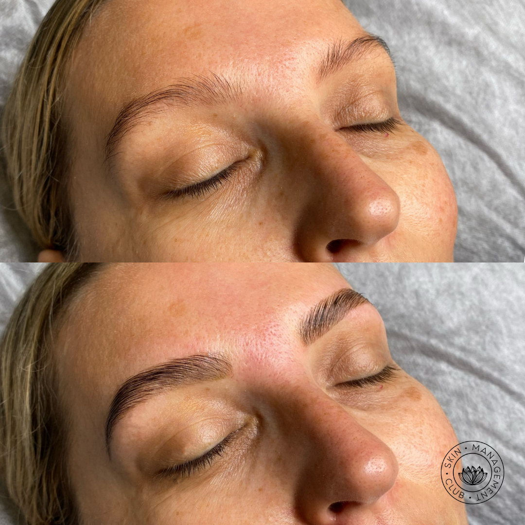 Gain control over your unruly brow with eyebrow lamination. Luxuriously smooth and shiny brows that hold just-the-right shape and look fantastic. Great for thinning or rebellious brows and a popular alternative to microblading.